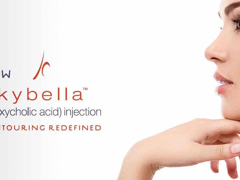 Kybella Injections