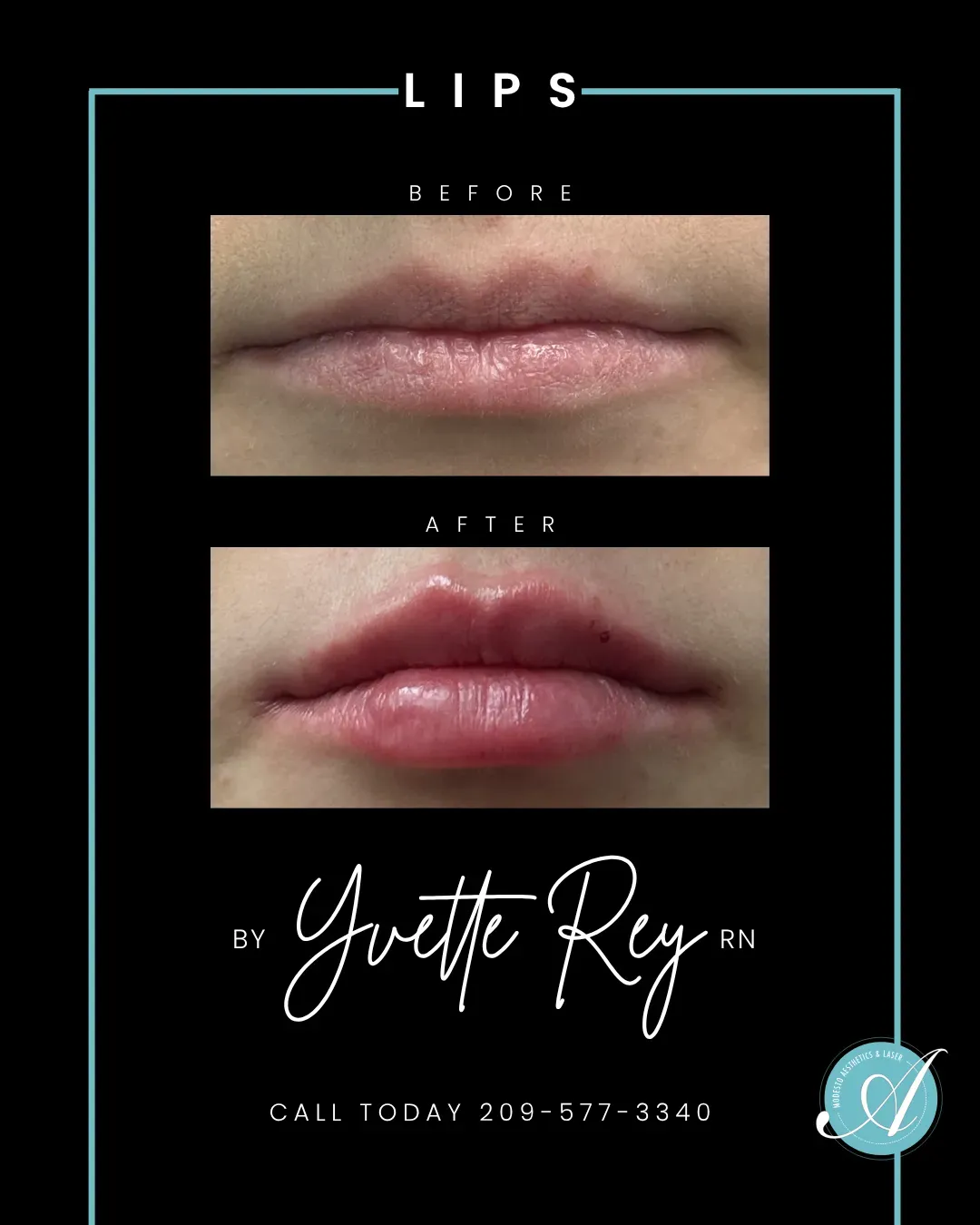 Lips before and after.