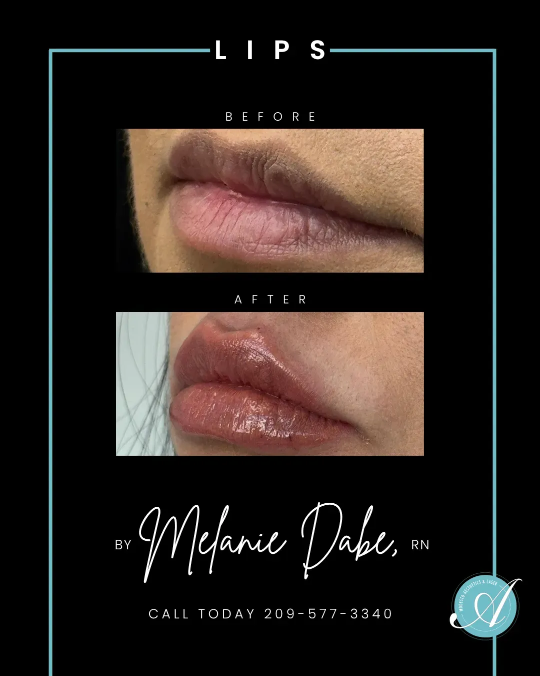 Lips before and after.