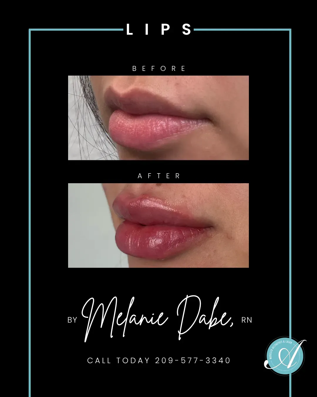 Lips before and after.