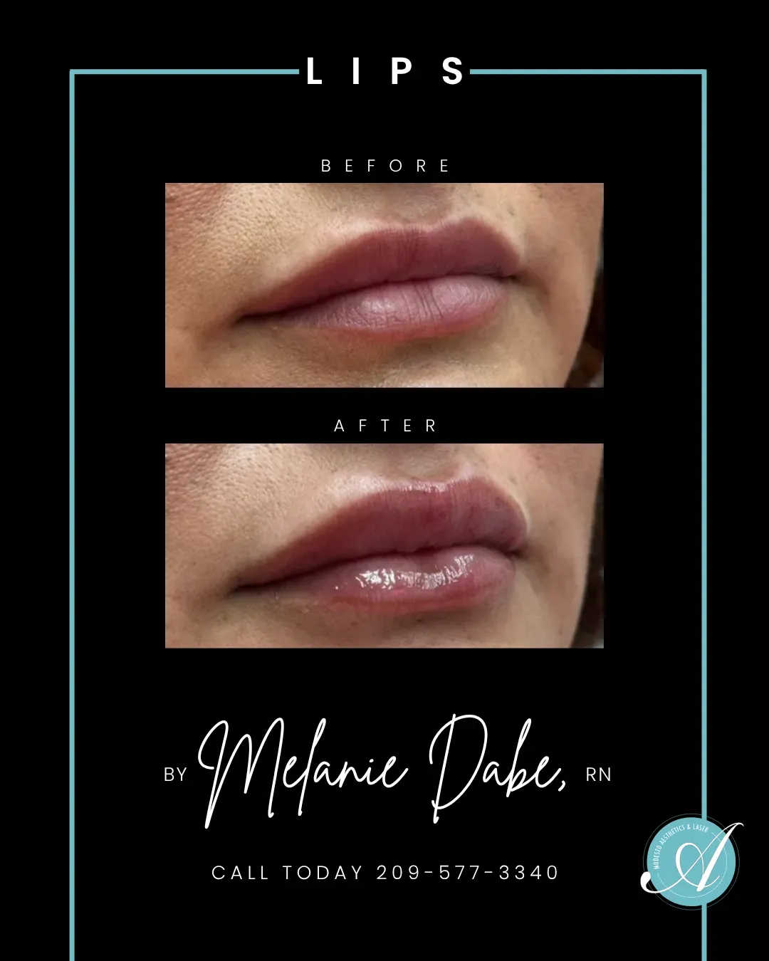 Lips before and after.