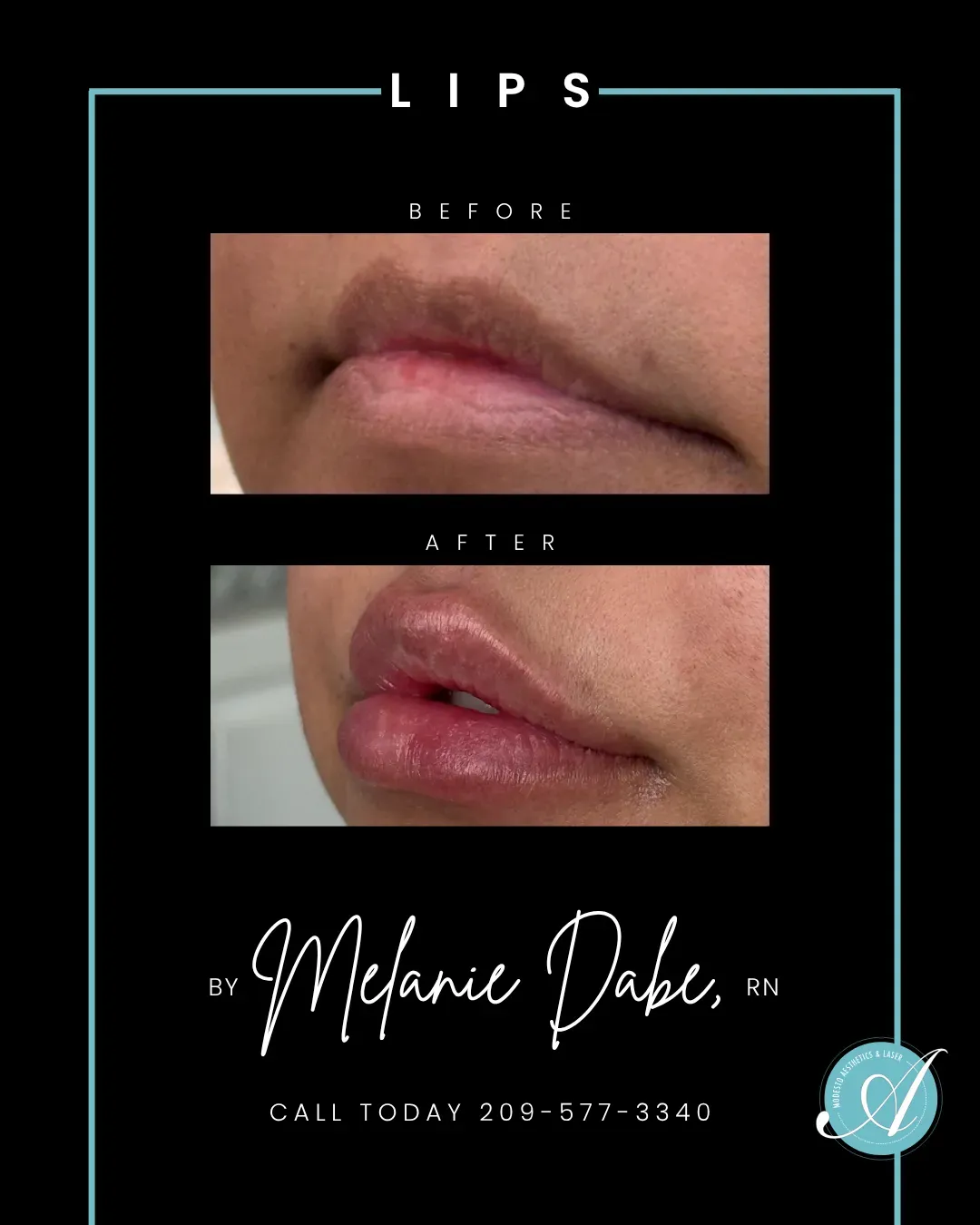 Lips before and after.