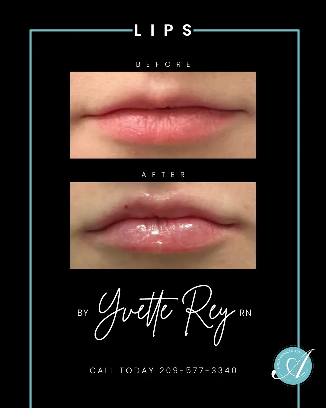 Lips before and after.