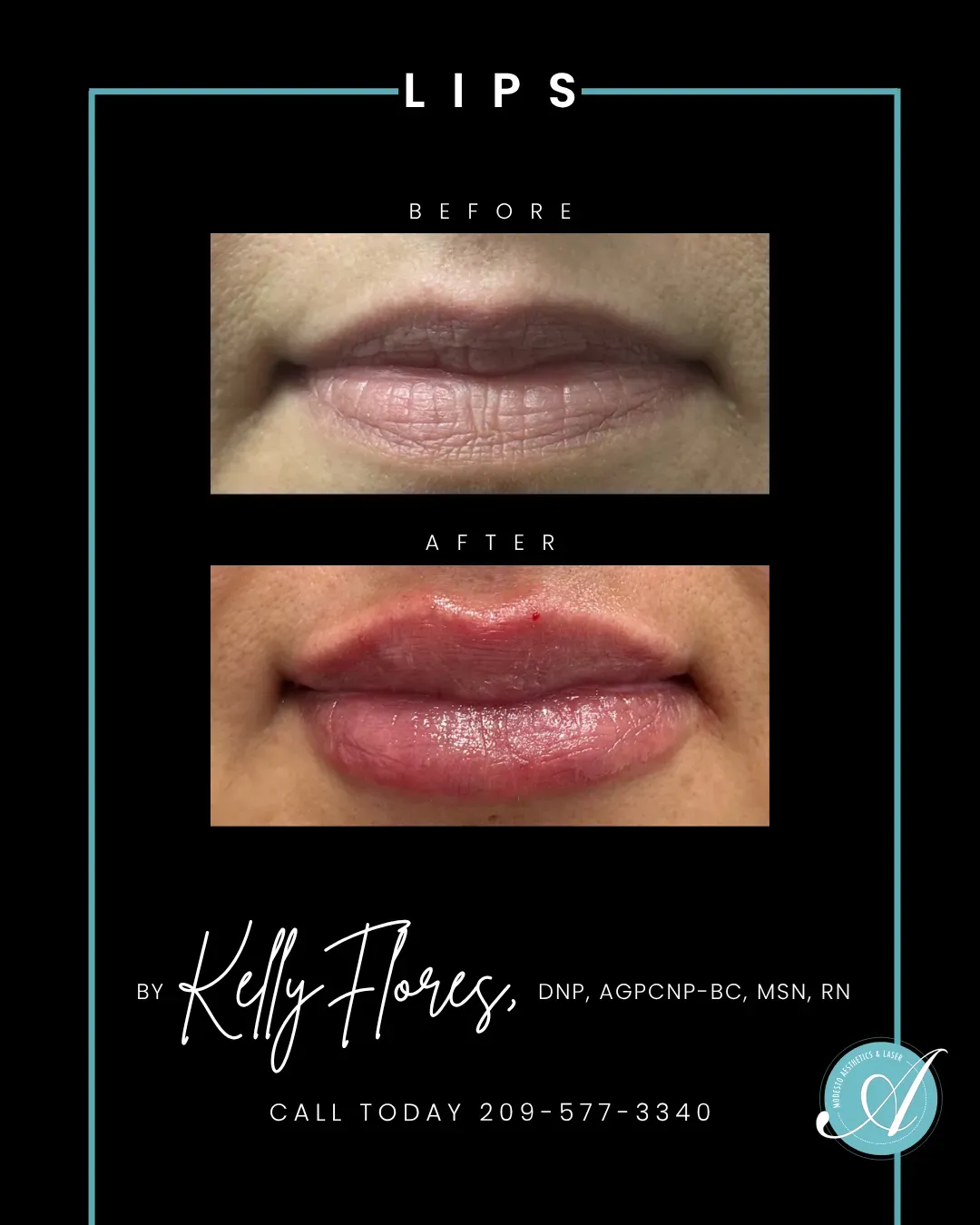 Lips before and after.