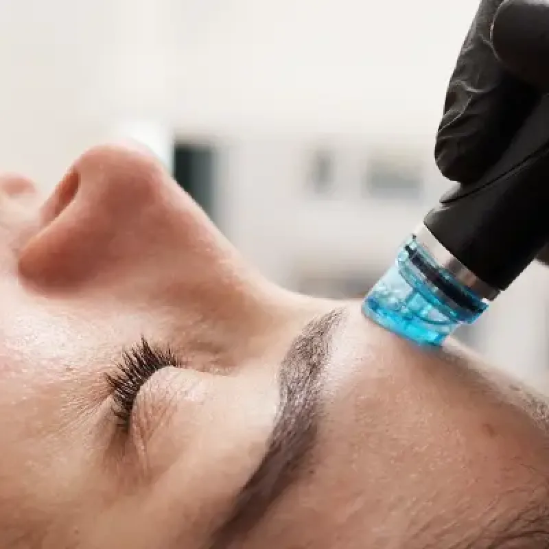 HydraFacial